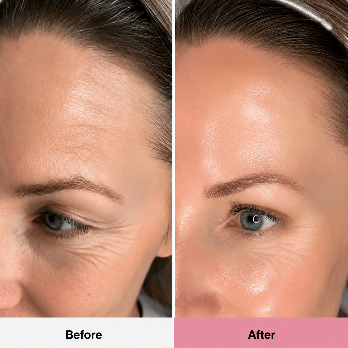 PDRN Pure Collagen Balm