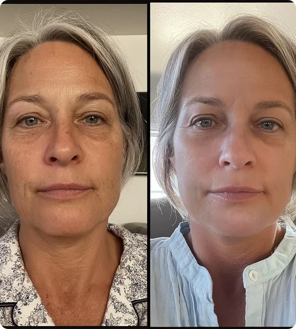 Amanda S., 56 skincare results