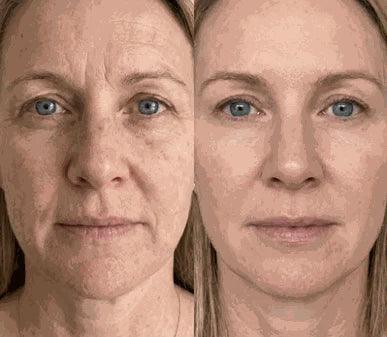 Veronica T., 44 skincare results